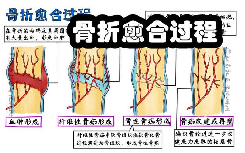 愈合过程