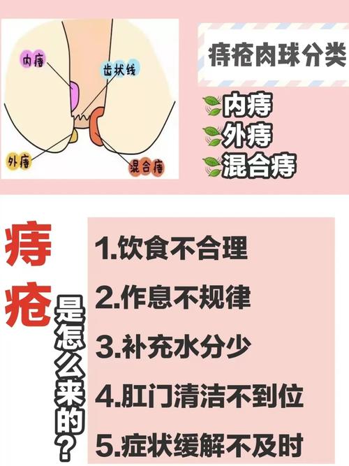 防止痔疮发作的方法有什么？