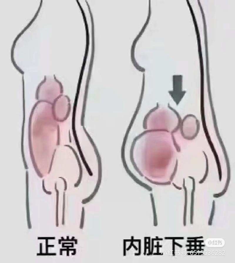 肚子下垂