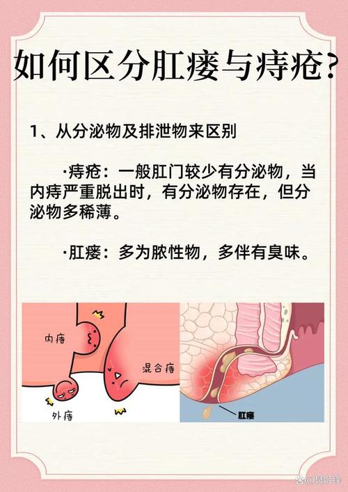 痔疮手术疗效显著，为何备受患者青睐？