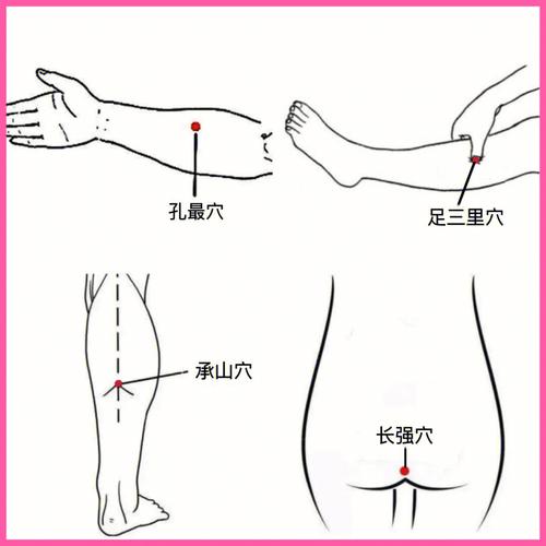 针灸治疗痔疮：哪个穴位最有效？