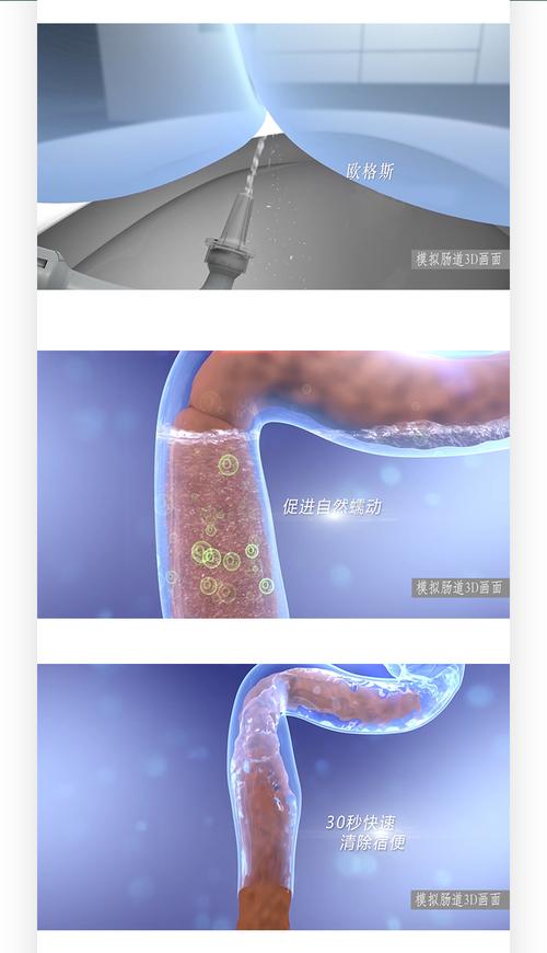 大肠水疗