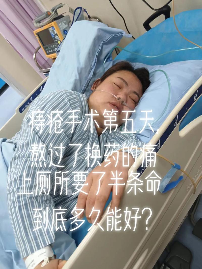 痔疮拆线后是否还需要继续换药？