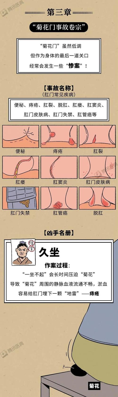 痔疮破皮擦屁股疼不疼？