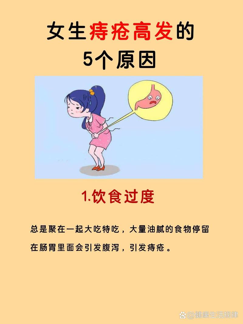 痔疮易发人群