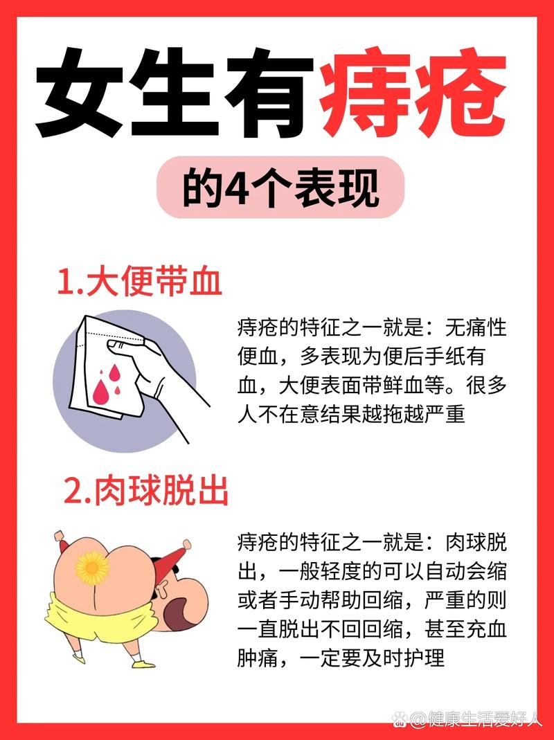 痔疮的症状：总想小便吗？