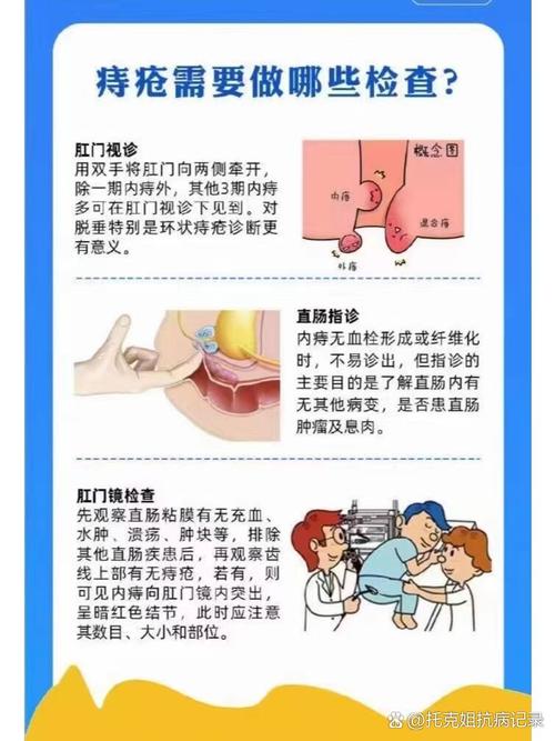 痔疮患者需进行哪些重要检查以明确诊断？