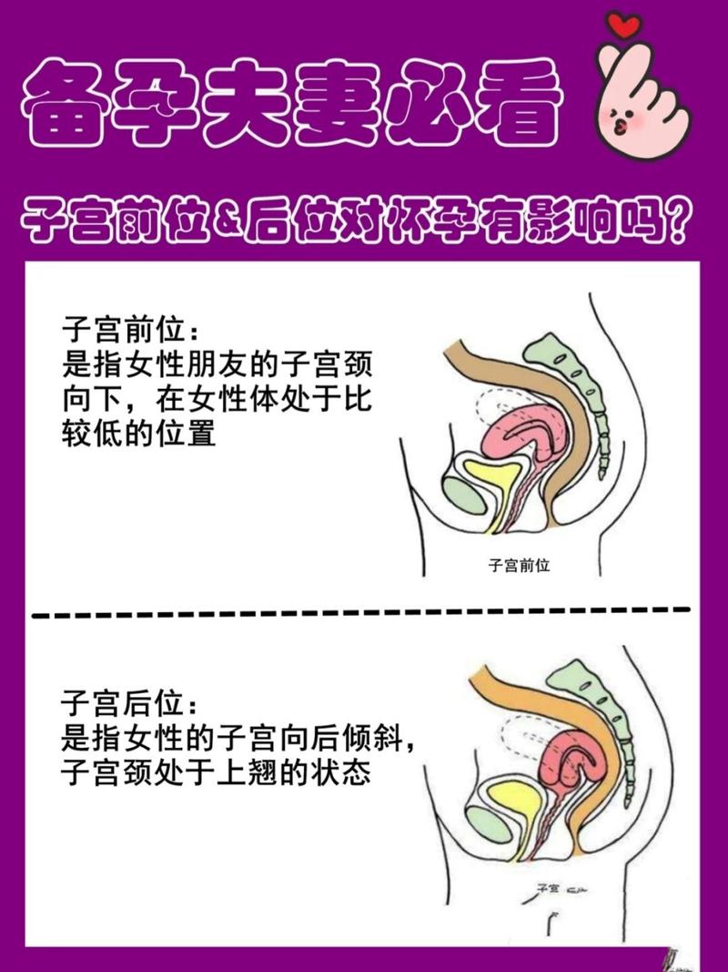 子宫后位