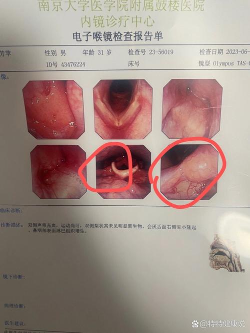 异物感