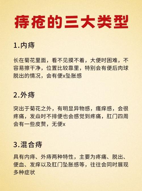 痔疮治疗误区知多少？这些观念害死人！