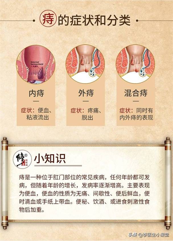 扁担杆治疗痔疮有效吗？