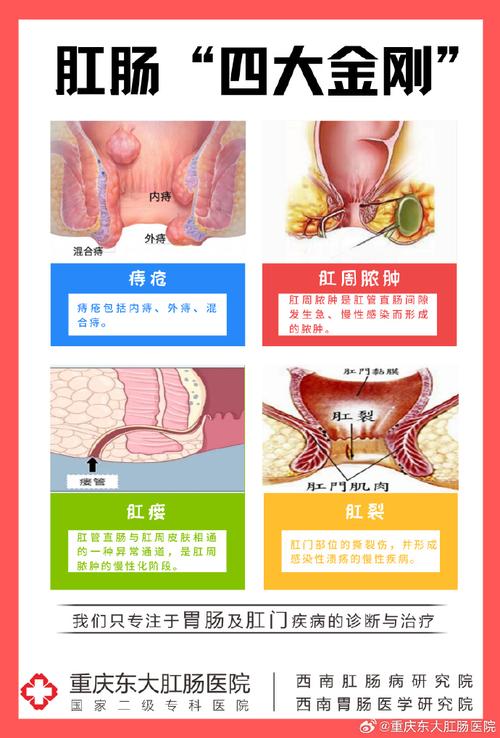 痔疮严重流血会引起头痛吗？