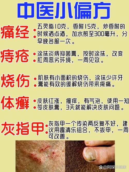 痔疮治疗：一周无效？试试这些偏方！