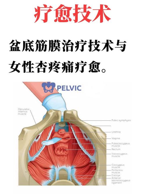 后背挑筋治疗痔疮的疼痛感究竟如何？