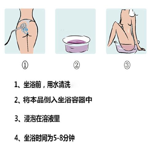 自行治疗痔疮的日常坐浴法是否有效？