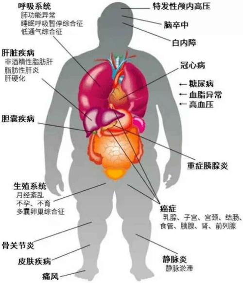 全身性疾病