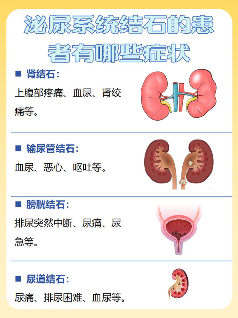 泌尿系统问题