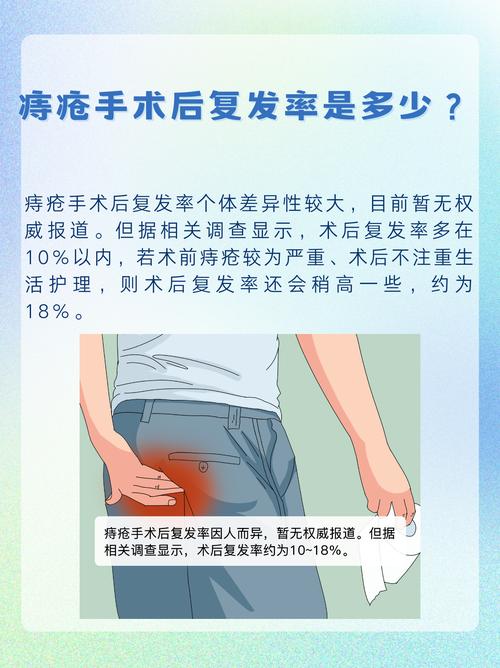 上守神是否可以有效治疗痔疮？专家解析