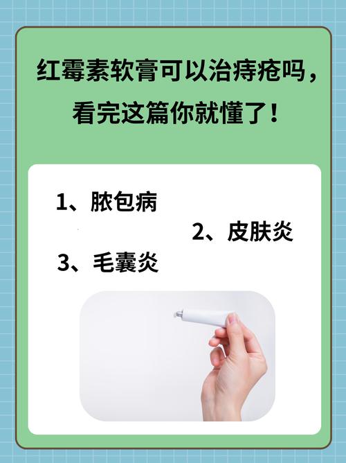 红霉素软膏是否可以有效缓解痔疮症状？